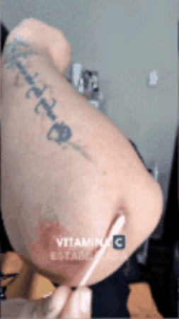 🌸✨ BIOAQUA DESPIGMENTANTE ÍNTIMO – Recobra la Confianza en tu Piel